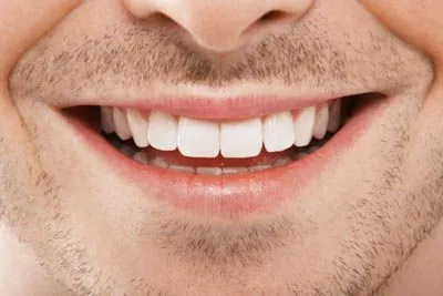 closeup of a restored smile after getting dental crowns